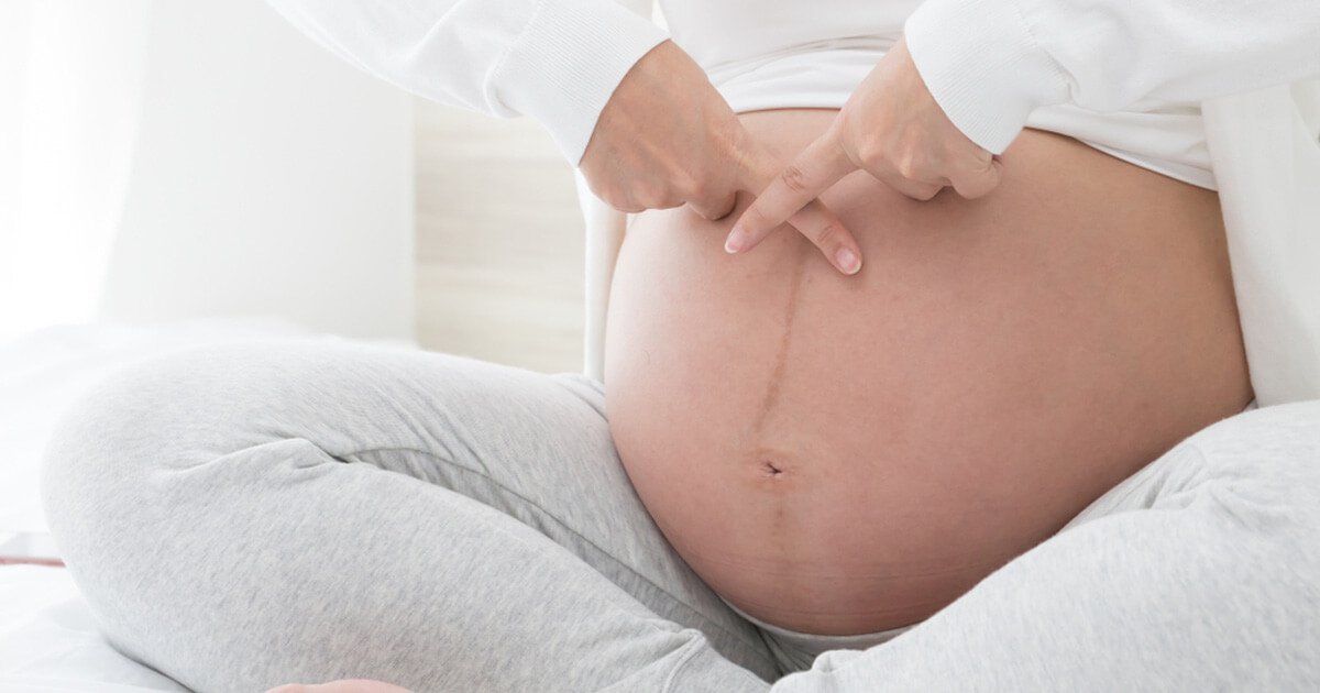 Schwangerschaftsbauch übergewicht Bauchumfang messen: