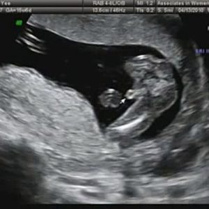 Es wird ein Junge!
