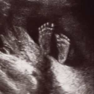 Die Füße auf dem Ultraschall