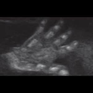 Hand des Babys im Ultraschall
