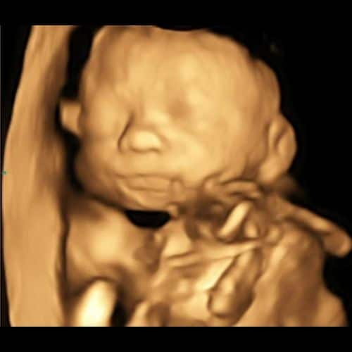 ᐅ 24 Ssw Schwangerschaftswoche Alle Infos Grosse Entwicklung