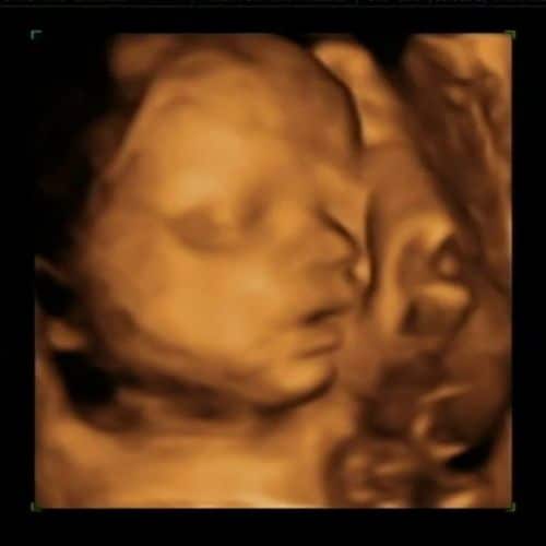 ᐅ 28 Ssw Schwangerschaftswoche Alle Infos Grosse Entwicklung