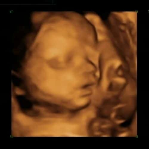 ᐅ 29 Ssw Schwangerschaftswoche Alle Infos Grosse Entwicklung
