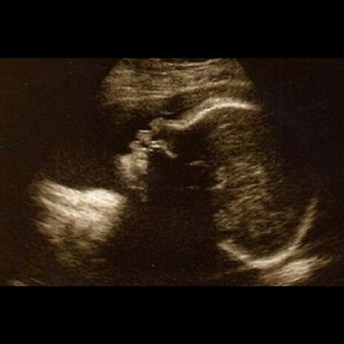 Monat welcher 30 schwanger woche SSW Rechner