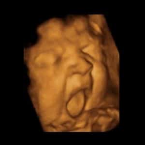 Gähnendes Baby im Ultraschall
