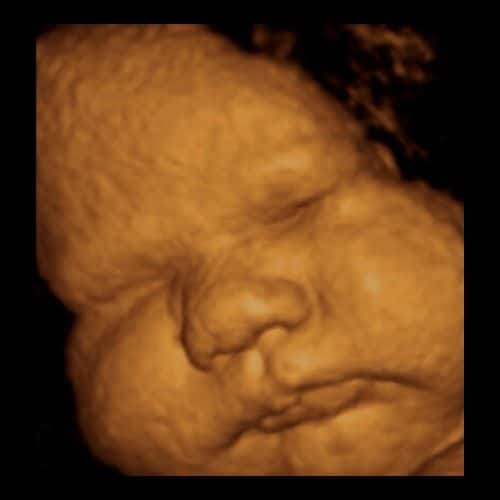 ᐅ 39 Ssw Schwangerschaftswoche Alle Infos Grosse Entwicklung