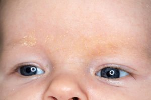 kopfgneis 3 - Babys 2. Woche: So entwickelt sich dein Baby