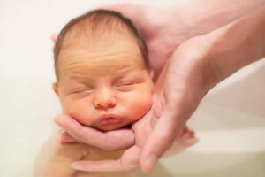 Gelbsucht Baby / Neugeborenengelbsucht