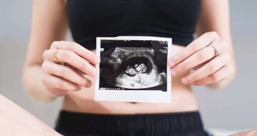 Ultraschall 12. Schwangerschaftswoche - geschlecht nicht erkennbar
