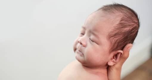 Kopfverformungen bei Neugeborenen