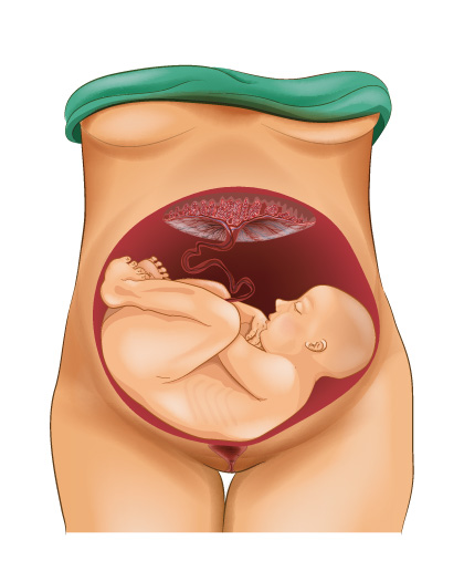 Baby in Querlage in der Gebärmutter