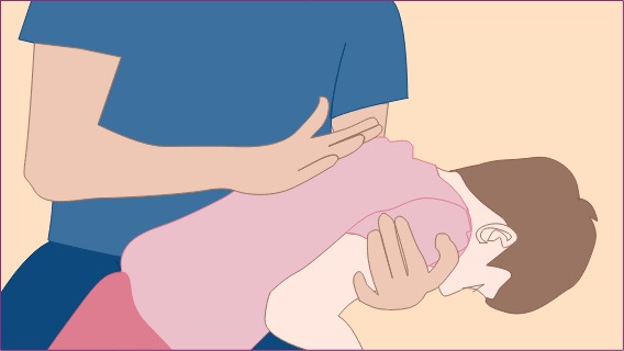 Erste Hilfe am Kind: zwischen Schulterblätter schlagen