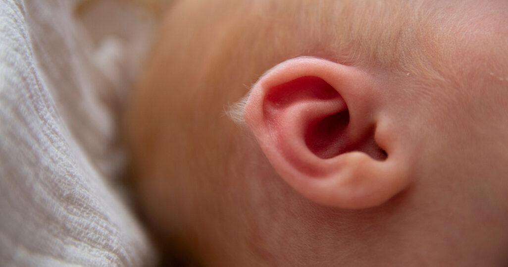 Lanugobehaarung beim neugeborenen Baby am Ohr