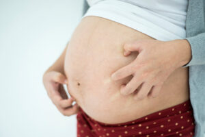 Juckreiz in der Schwangerschaft ist unangenehm, aber ist er schlimm?