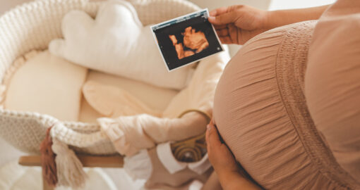 Schwangere mit Ultraschallbild in der Hand